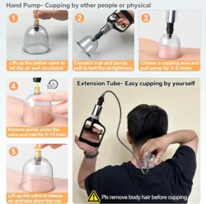 ODM OEM 16 Cupping Cups Pain Relief Chinese Muscle Cupping Tool with Pump Vacuum Silicone Cups for Cellulite Reduction at Home